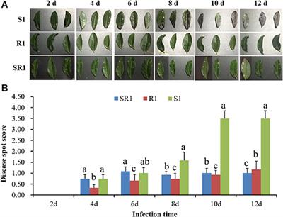 Metabolome and Microbiome Signatures in the Leaves of Wild Tea Plant Resources Resistant to Pestalotiopsis theae